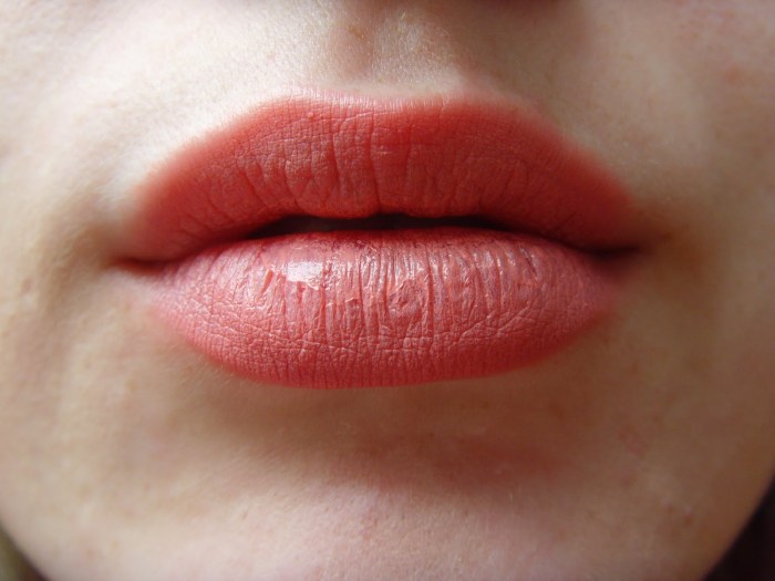 Lips chapped remedy shefinds