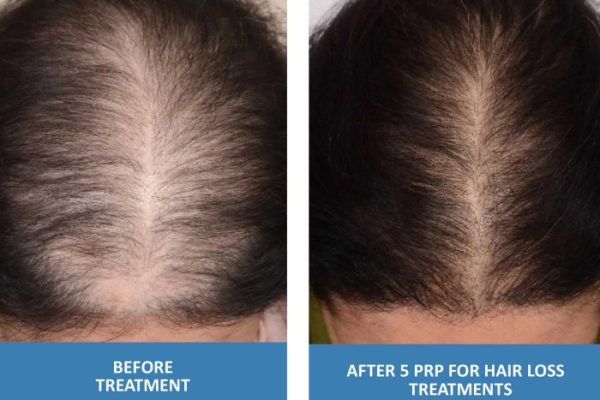 Hair treatments tucson az